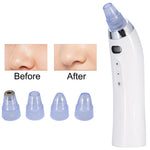 Face Pore Cleaner Blackhead Remover Vacuum Comedo Suction Diamond Dermabrasion Facial Cleaning Beauty Machine SSwell