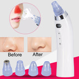 Face Pore Cleaner Blackhead Remover Vacuum Comedo Suction Diamond Dermabrasion Facial Cleaning Beauty Machine SSwell