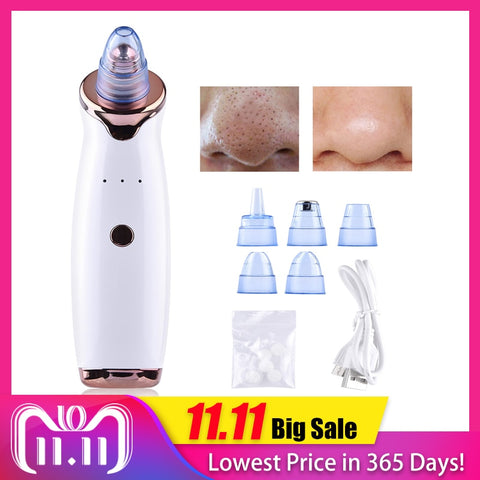 Blackhead Vacuum Remover